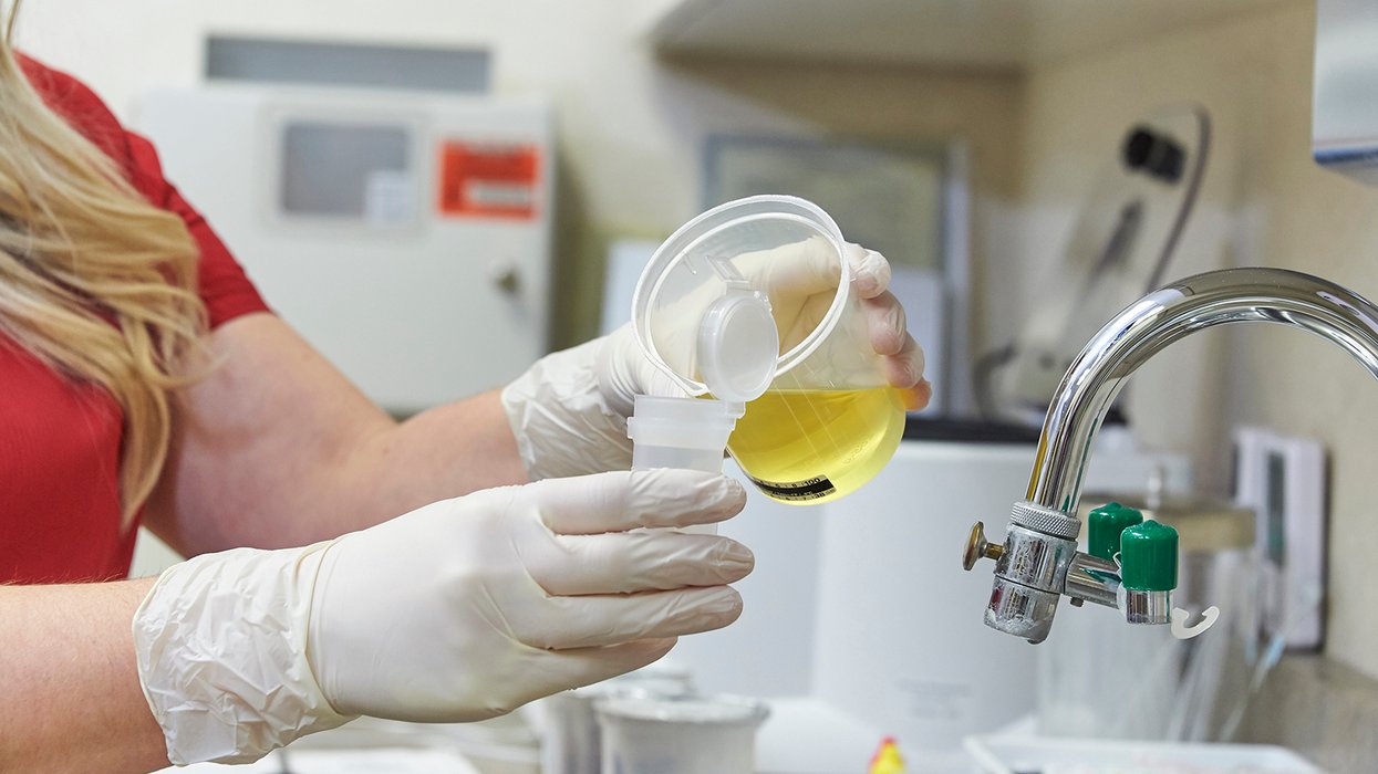 The importance of the split specimen in drug testing | J. J. Keller ...