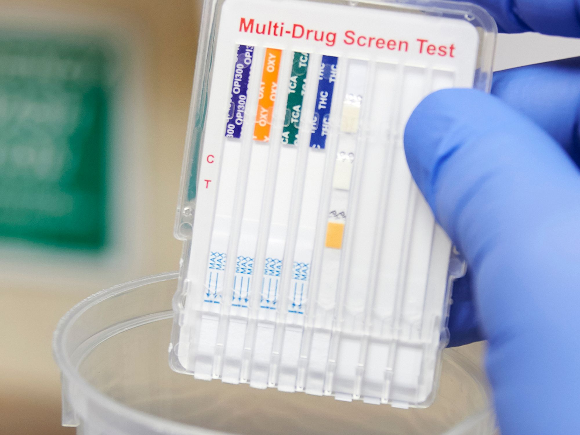 Drug and alcohol testing overview