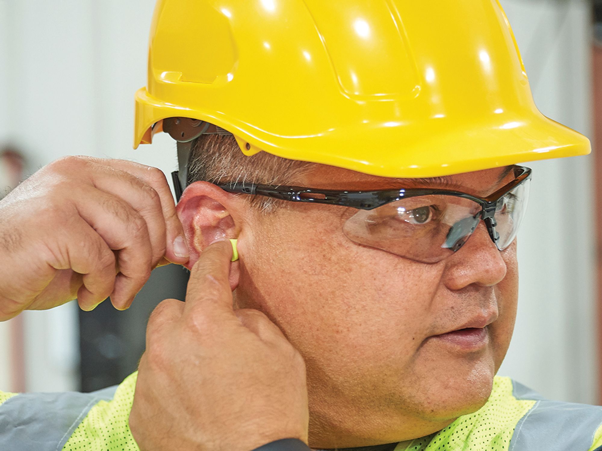 What is the basic requirement for recording hearing loss cases?