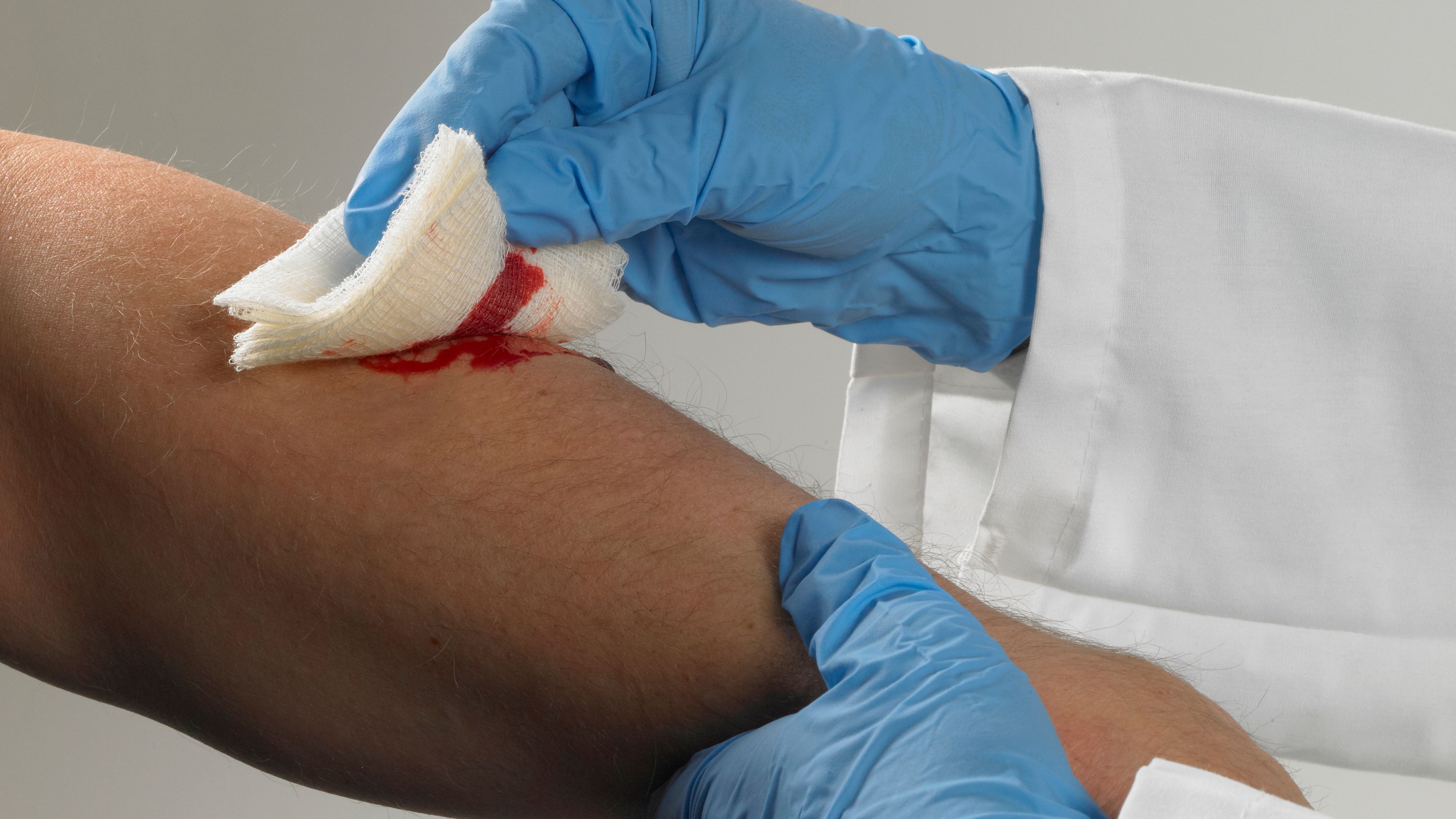 Bloodborne pathogens Proper glove use and disposal J. J. Keller