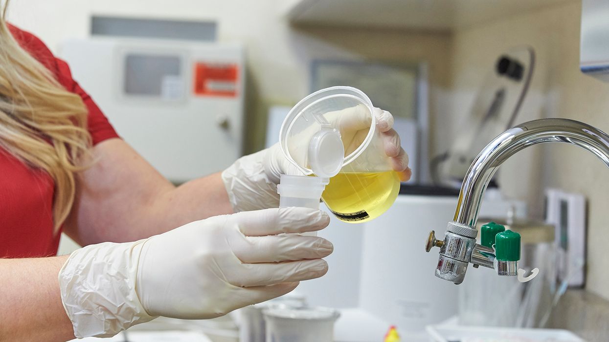 The importance of the split specimen in drug testing