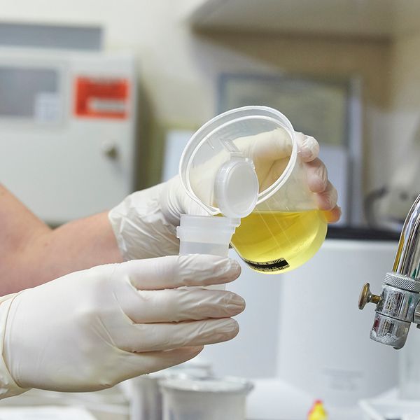 The importance of the split specimen in drug testing