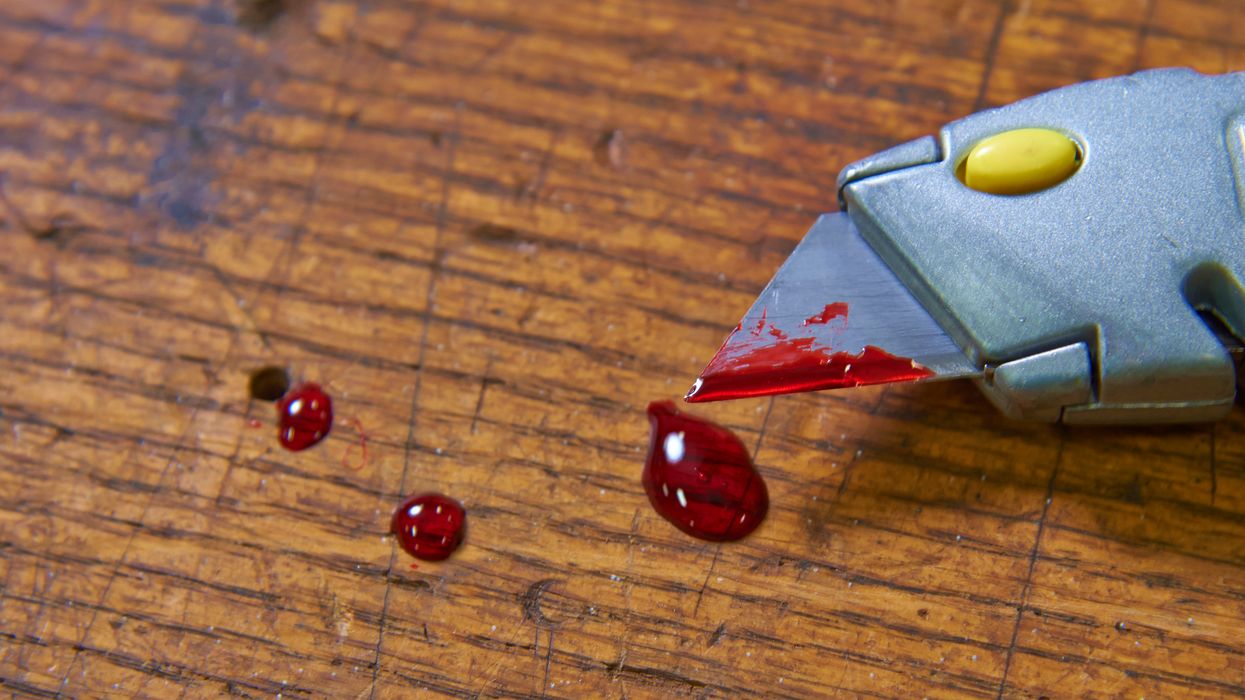 Unmasking the top three OSHA violations for bloodborne pathogens