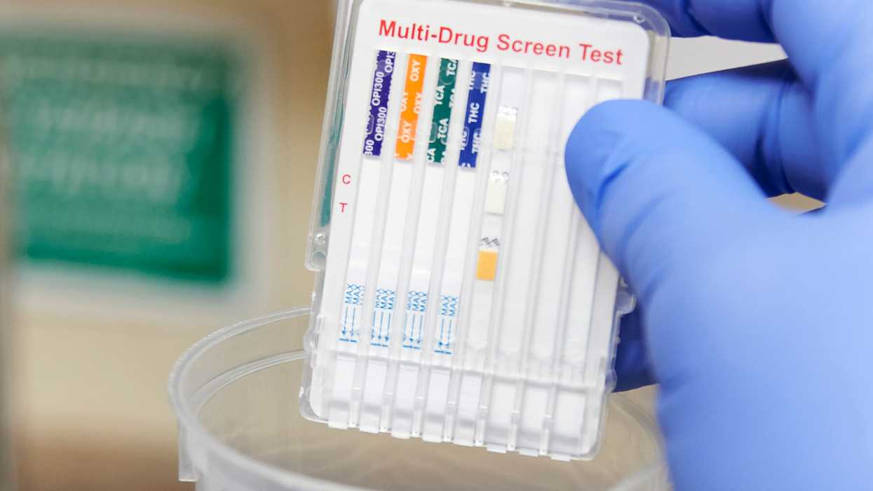 Drug testing summer workers? Don’t get burned!