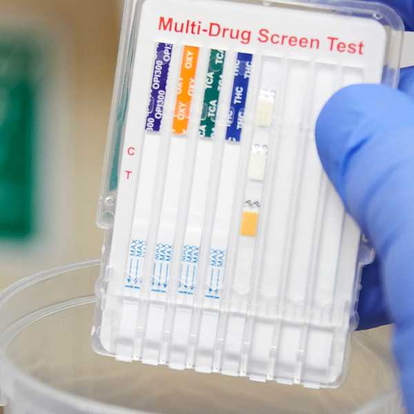 Drug testing summer workers? Don’t get burned!