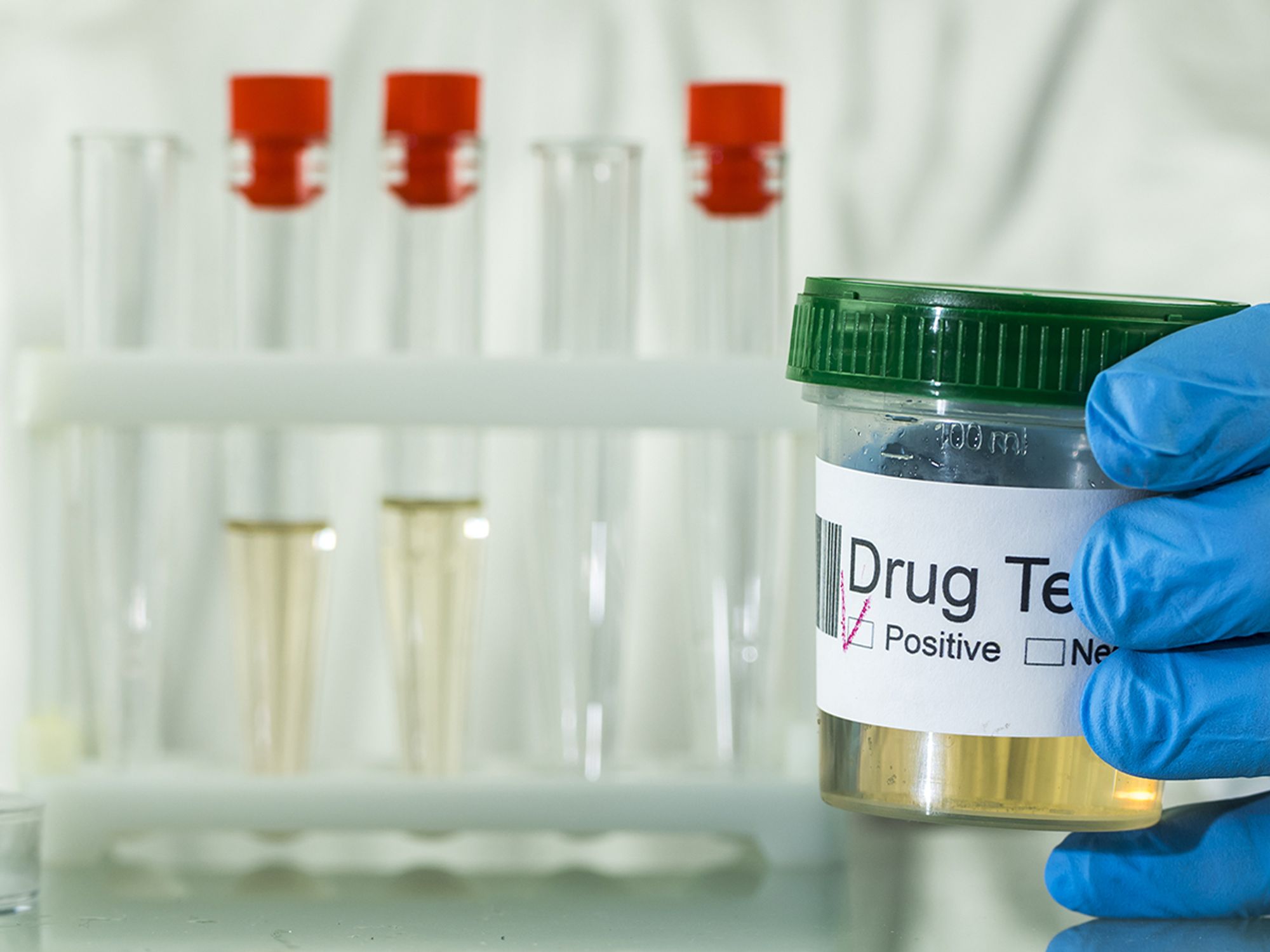 Return-to-duty drug testing