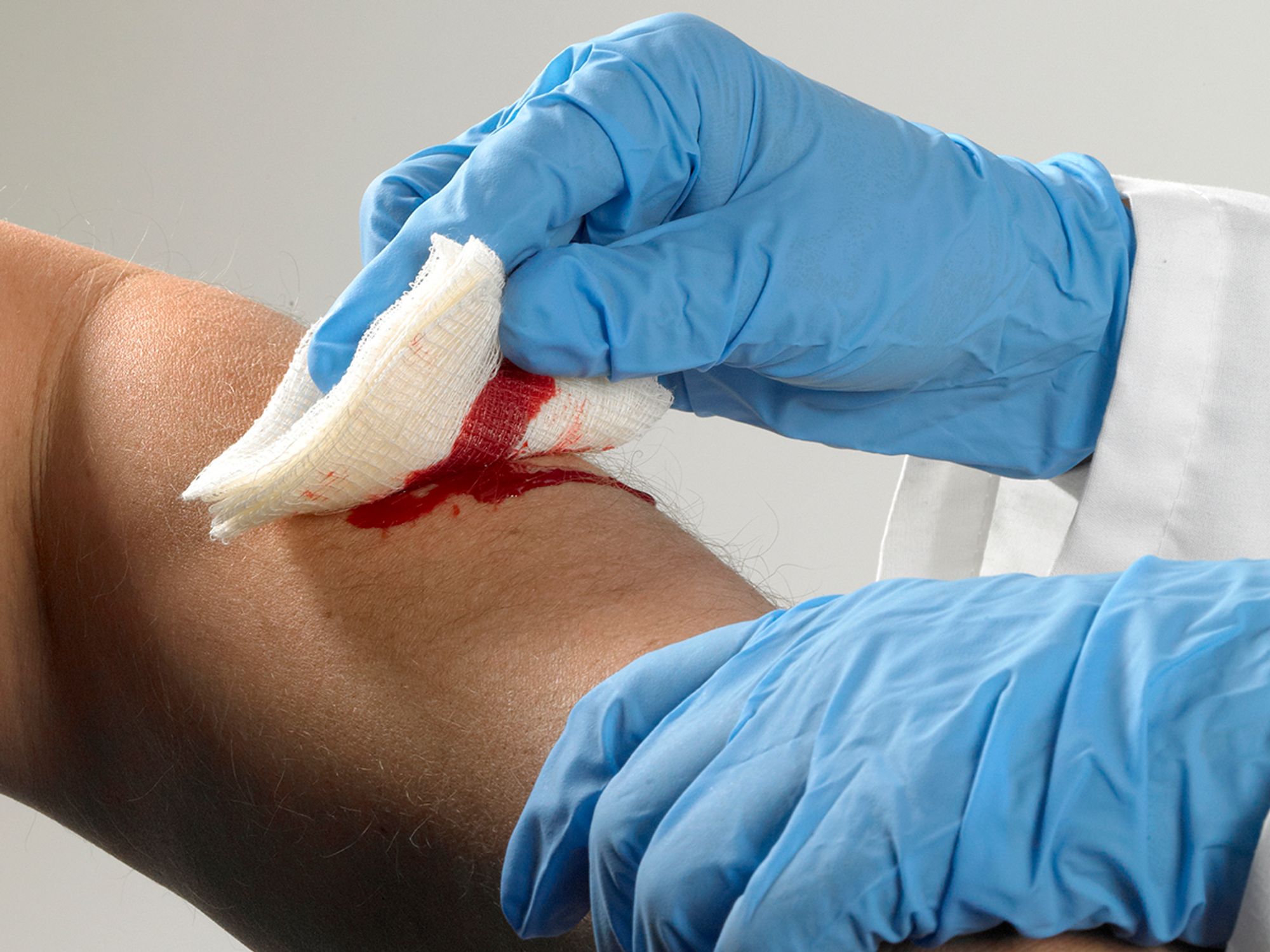 What kinds of cases are considered a privacy concern?