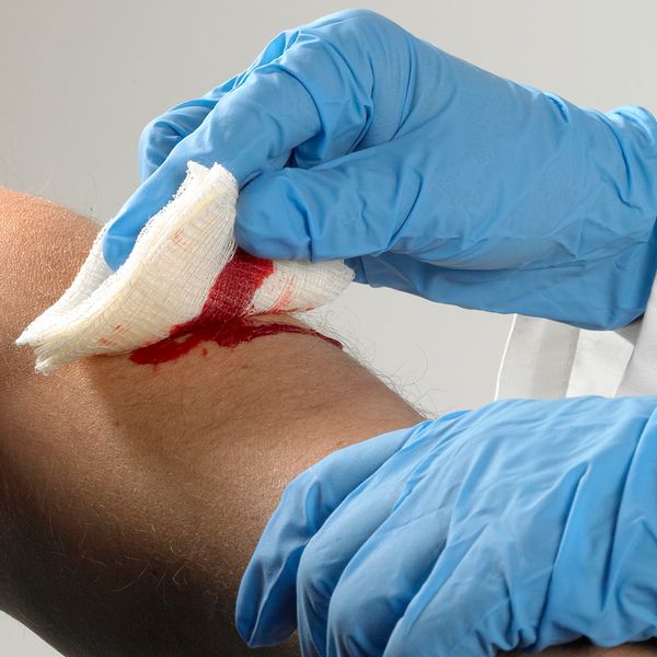 Remote worker injuries, OSHA recordkeeping, and workers’ compensation