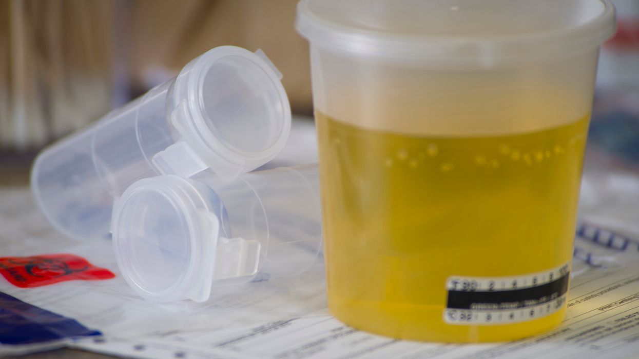 The costly consequences of errors in DOT drug screening