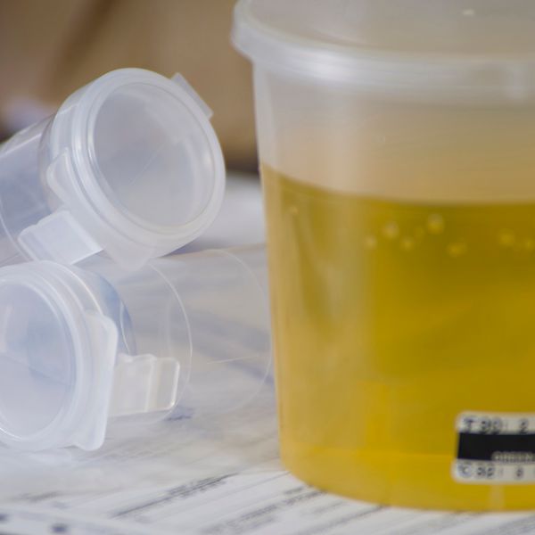 The costly consequences of errors in DOT drug screening