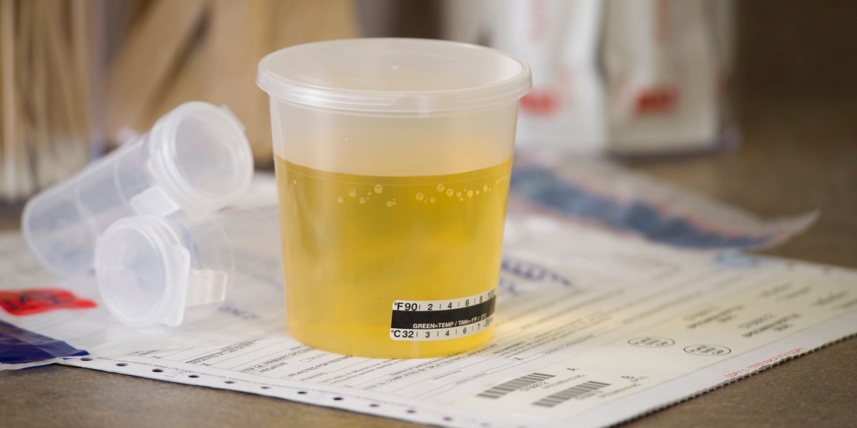 Dilute drug test? Follow these steps to compliance | J. J. Keller