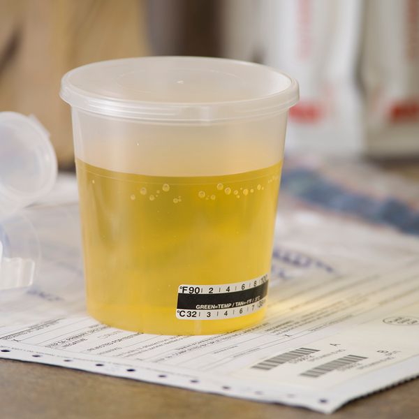 Dilute drug test? Follow these steps to compliance