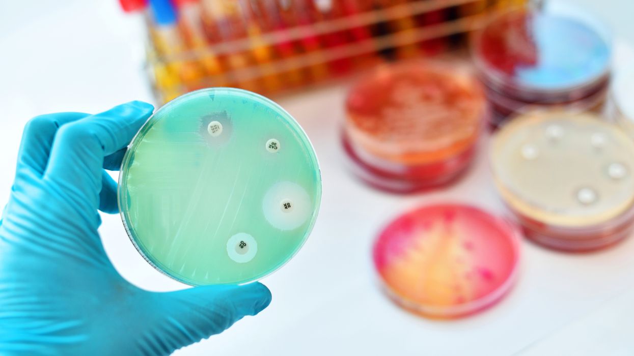 Monkeypox cases are on the rise: Are your workers protected?