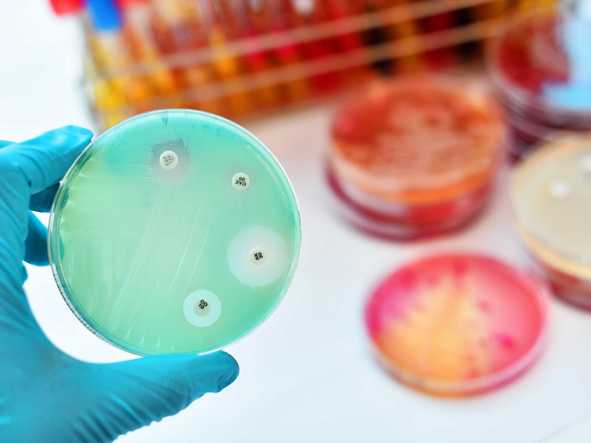 MRSA