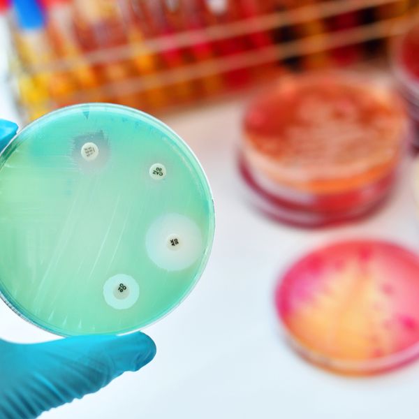 Monkeypox cases are on the rise: Are your workers protected?