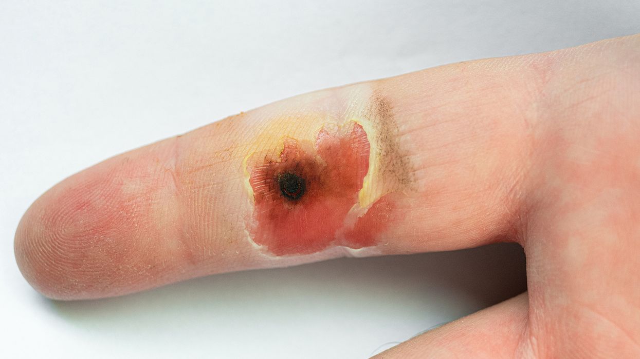 Quick Tip: Emphasize the importance of understanding hazards!