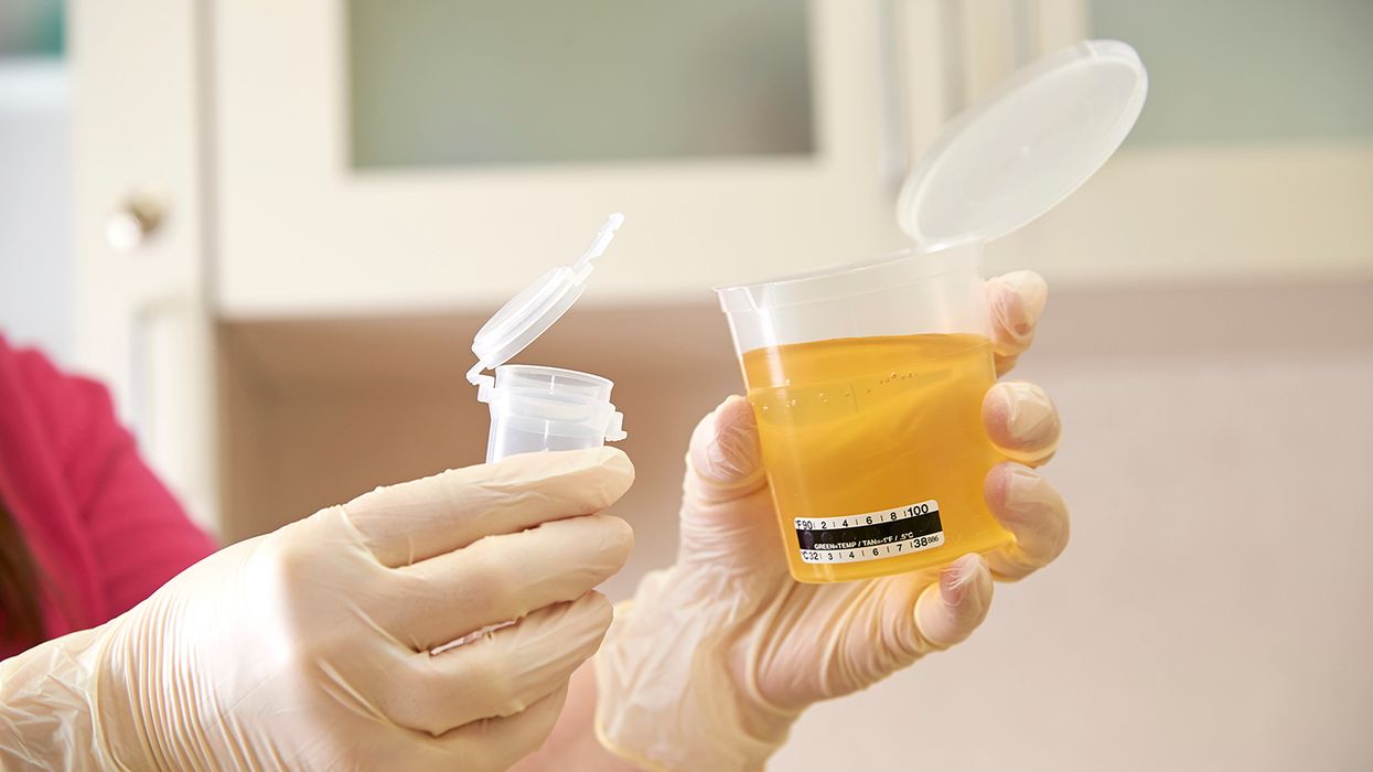 Testing for additional drugs still taboo for DOT tests