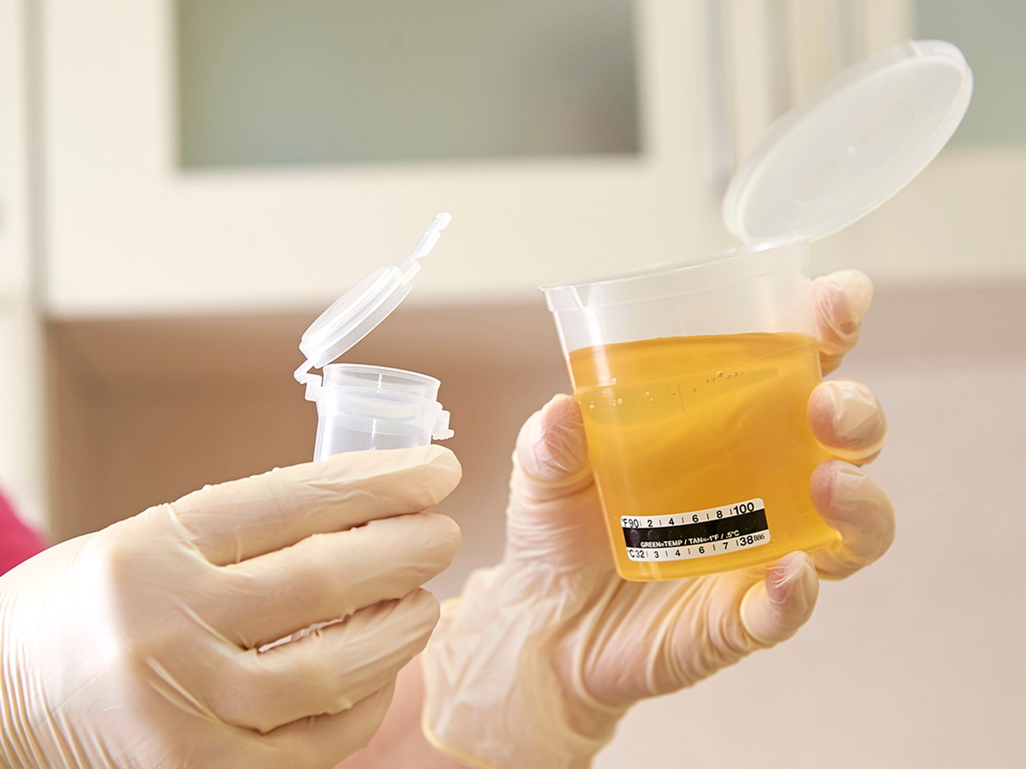 Split specimen procedures