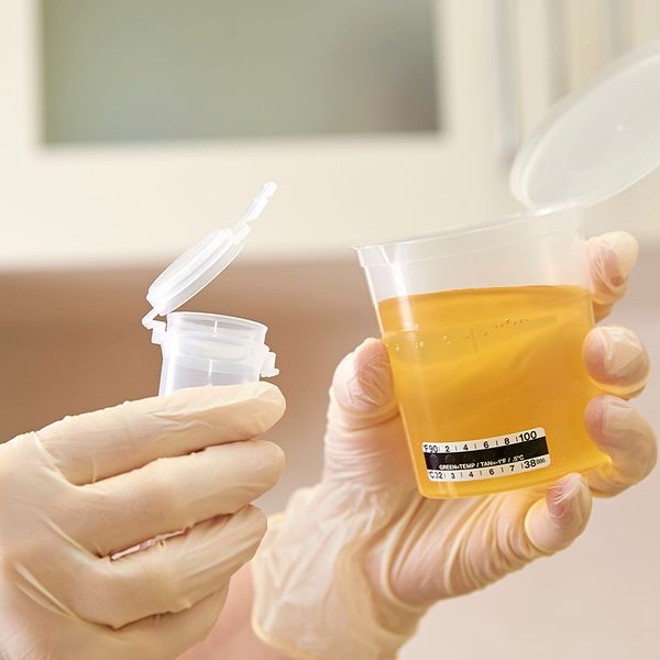 Testing for additional drugs still taboo for DOT tests