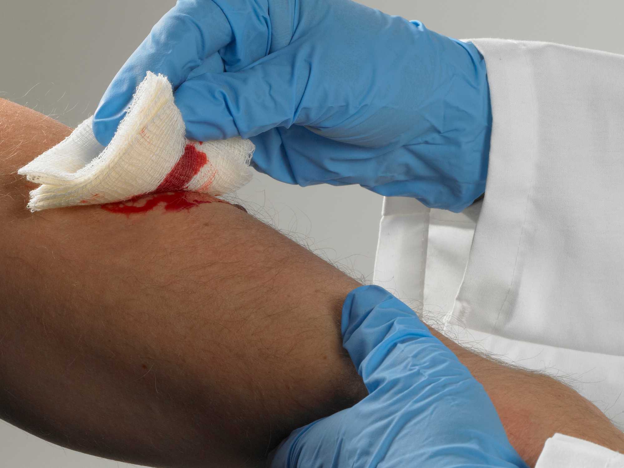 Universal precautions