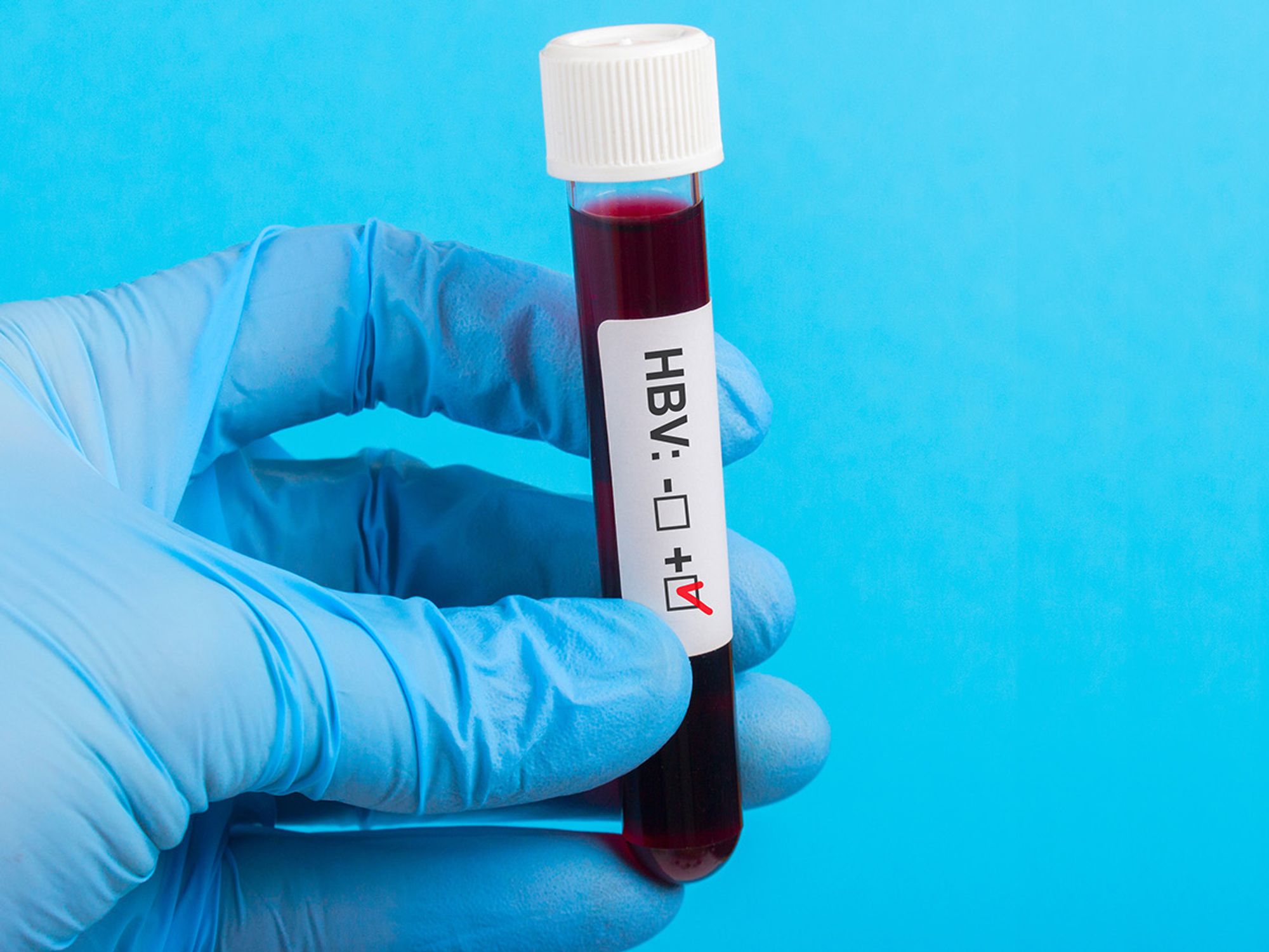HIV/HBV labs and production facilities