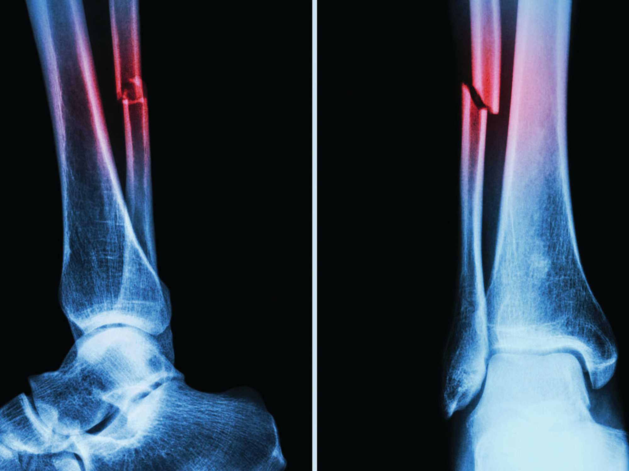 Healthcare worker injuries and illnesses