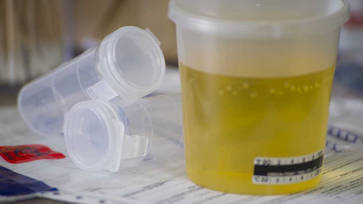 The costly consequences of errors in DOT drug screening