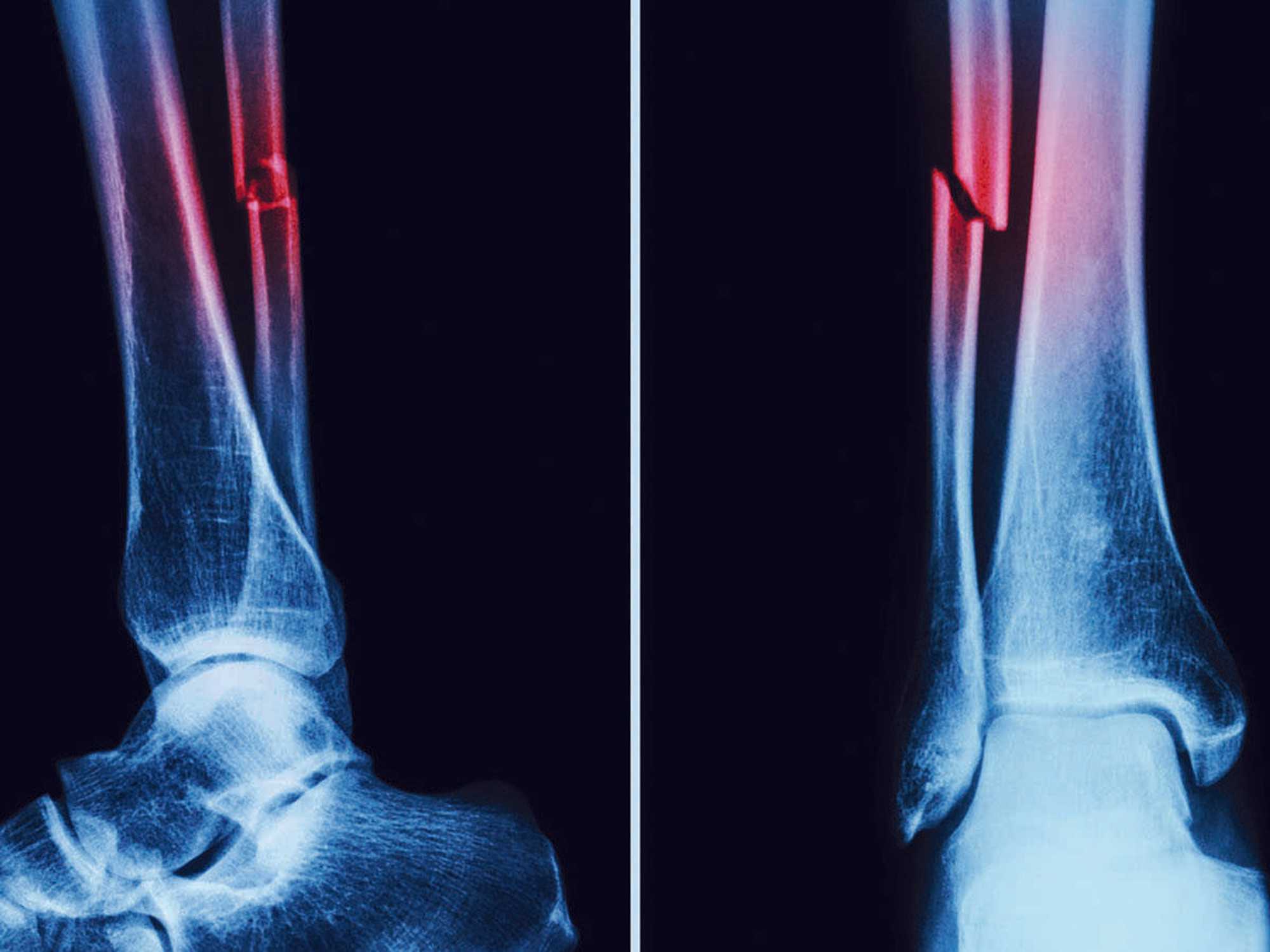 Healthcare worker injuries and illnesses
