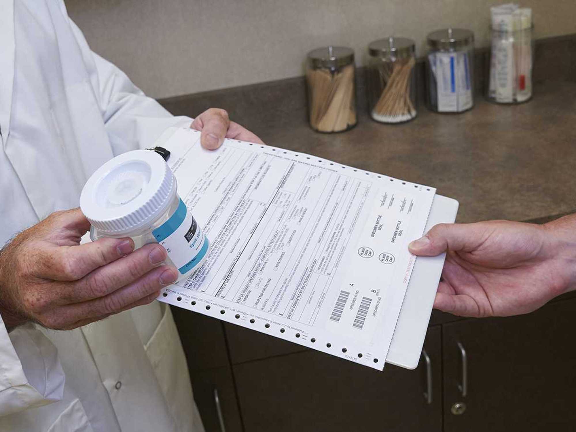 Random drug tests