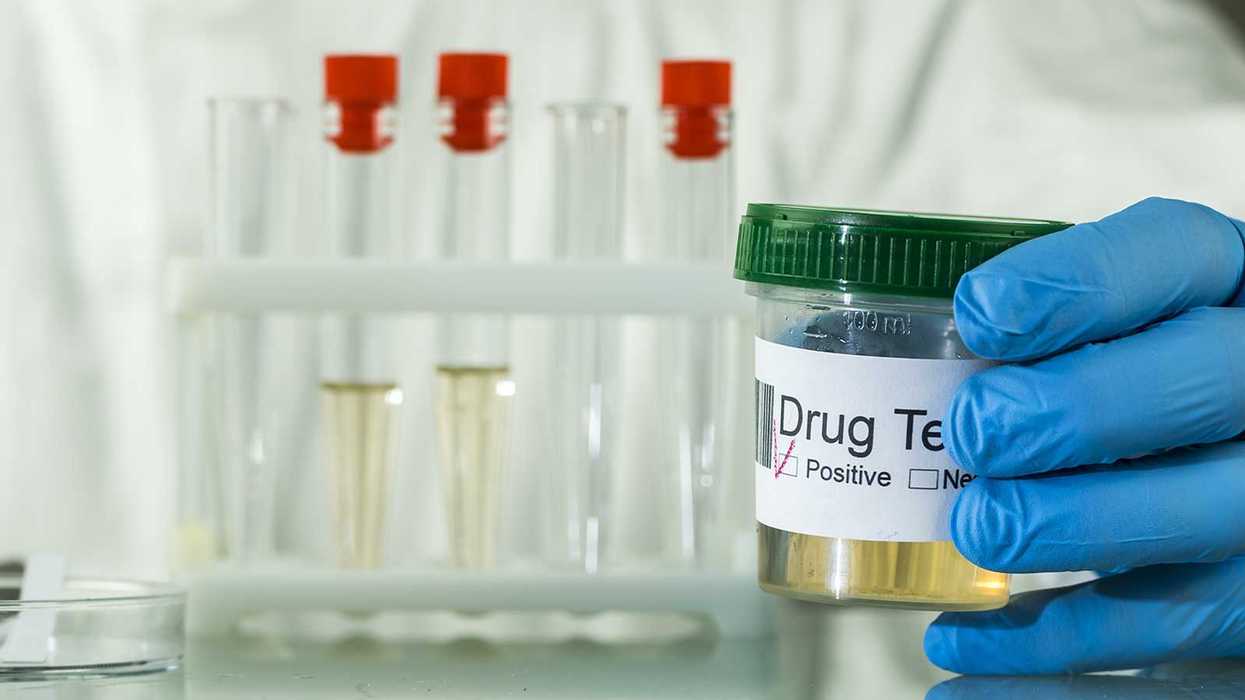 Should summer hires be tested for marijuana? 5 things to consider