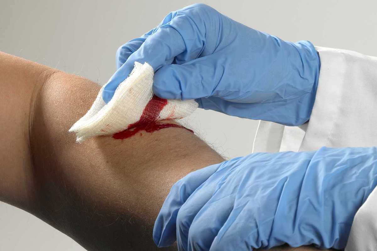 Recordkeeping Implications: Butterfly Strips vs. Surgical Glue