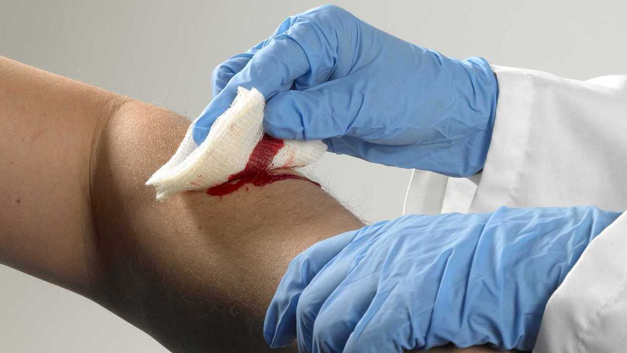 Recordkeeping Implications: Butterfly Strips vs. Surgical Glue
